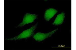 Immunofluorescence of purified MaxPab antibody to RBX1 on HeLa cell. (RBX1 抗体  (AA 1-108))