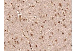 Paraformaldehyde-fixed, paraffin embedded rat brain, Antigen retrieval by boiling in sodium citrate buffer (pH6) for 15min, Block endogenous peroxidase by 3% hydrogen peroxide for 30 minutes,  Blocking buffer (normal goat serum) at 37°C for 20min, Antibody incubation with FGFR1/FGFR2 (Tyr463/Tyr466) Antibody (bs-5326R) at 1:400 overnight at 4°C, followed by a conjugated secondary and DAB staining. (FGFR1/FGFR2 抗体  (pTyr463, pTyr466))