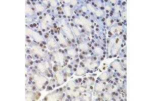 Immunohistochemistry of paraffin-embedded rat pancreas using CREB1 Antibody. (CREB1 抗体)