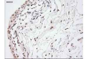 Immunohistochemical staining of paraffin-embedded lung tissue using anti-GAD1mouse monoclonal antibody.