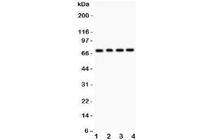 Western blot testing of FOXO1 antibody and Lane 1:  rat lung;  2: (r) brain;  3: human COLO320;  4: (h) HEPG2. (FOXO1 抗体  (AA 456-655))