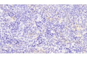 Detection of GM-CSF in Mouse Spleen Tissue using Polyclonal Antibody to Colony Stimulating Factor 2, Granulocyte Macrophage (GM-CSF) (GM-CSF 抗体  (AA 19-141))