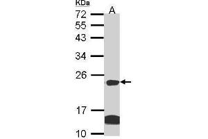 WB Image Sample (30 ug of whole cell lysate) A: Hela B: Hep G2 , 12% SDS PAGE antibody diluted at 1:1000 (CLDN14 抗体  (C-Term))