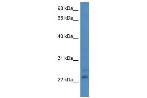 Western Blot showing CBR4 antibody used at a concentration of 1-2 ug/ml to detect its target protein. (CBR4 抗体  (N-Term))