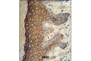 KRT1 Antibody (Center) (ABIN653648 and ABIN2842989) IHC analysis in formalin fixed and paraffin embedded skin tissue followed by peroxidase conjugation of the secondary antibody and DAB staining. (Cytokeratin 1 抗体  (AA 415-443))