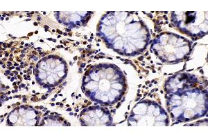 Detection of EP300 in Human Colon Tissue using Polyclonal Antibody to E1A Binding Protein P300 (EP300) (p300 抗体  (AA 1351-1601))