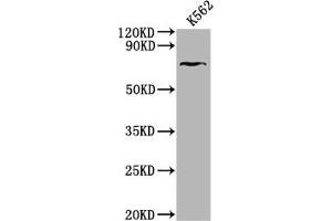 Western Blot Positive WB detected in: K562 whole cell lysate All lanes: HHIP antibody at 1:2000 Secondary Goat polyclonal to rabbit IgG at 1/50000 dilution Predicted band size: 79, 37 kDa Observed band size: 79 kDa (HHIP 抗体  (AA 183-424))