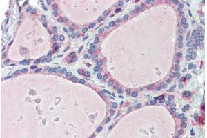 Immunohistochemistry (IHC) image for anti-Extended Synaptotagmin-Like Protein 1 (ESYT1) (C-Term) antibody (ABIN960776)