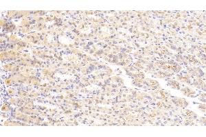 Detection of LAMa2 in Mouse Stomach Tissue using Polyclonal Antibody to Laminin Alpha 2 (LAMa2) (Laminin 抗体  (AA 2901-3106))