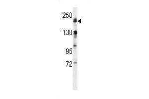 Western blot analysis in human normal Uterus tissue lysates (35ug/lane). (MAP3K4 抗体  (AA 1067-1097))