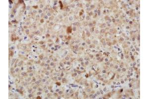 Paraformaldehyde-fixed, paraffin embedded rat pancreas tissue, Antigen retrieval by boiling in sodium citrate buffer(pH6) for 15min, Block endogenous peroxidase by 3% hydrogen peroxide for 30 minutes, Blocking buffer (normal goat serum) at 37°C for 20min, Antibody incubation with Rabbit Anti-PERK (Thr980) Polyclonal Antibody, Unconjugated  at 1:400 overnight at 4°C, followed by a conjugated secondary and DAB staining (PERK 抗体  (pThr980))
