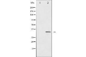Western blot analysis of IGFBP-3 expression in HuvEc whole cell lysates,The lane on the left is treated with the antigen-specific peptide. (IGFBP3 抗体  (Internal Region))
