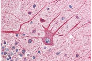 Human Brain, Cerebellum (formalin-fixed, paraffin-embedded) stained with EIF2AK2 antibody ABIN214488 at 2. (EIF2AK2 抗体  (C-Term))