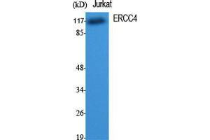 Western Blot (WB) analysis of specific cells using ERCC4 Polyclonal Antibody. (ERCC4 抗体  (C-Term))