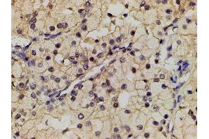 Immunohistochemistry (IHC) image for anti-Phosphoinositide 3 Kinase, p85 alpha (PI3K p85a) (pTyr607) antibody (ABIN6256775)