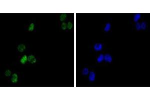 Immunofluorescence analysis of K562(left) cells using GATA1 mouse mAb (green). (GATA1 抗体)