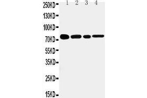 Anti-TNF Receptor II antibody, Western blotting Lane 1: Rat Spleen Tissue Lysate Lane 2: Rat Brain Tissue Lysate Lane 3: Mouse Brain Tissue Lysate Lane 4: HEPA Cell Lysate