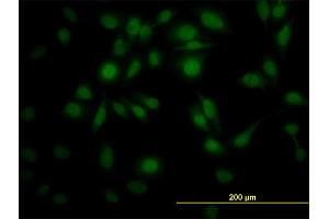 Immunofluorescence of monoclonal antibody to PPIL4 on HeLa cell. (PPIL4 抗体  (AA 395-466))