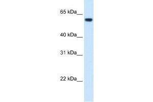 FTCD antibody used at 1. (FTCD 抗体  (N-Term))