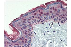 Human Skin: Formalin-Fixed, Paraffin-Embedded (FFPE) (MMP3 抗体  (Ser373))