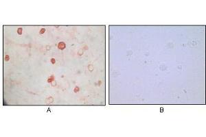 Immunocytochemistry analysis of TPA induced BCBL-1 cells (A) and uninduced BCBL-1 cells (B) using KSHV K8a antibody with AEC staining. (KSHV K8 alpha 抗体)