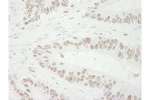 Immunohistochemistry (IHC) image for anti-Minichromosome Maintenance Complex Component 3 (MCM3) (AA 500-550) antibody (ABIN7448651) (MCM3 抗体  (AA 500-550))