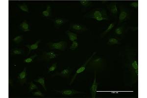 Immunofluorescence of monoclonal antibody to CARHSP1 on HeLa cell.