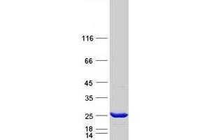 Western Blotting (WB) image for Glutathione S-Transferase kappa 1 (GSTK1) (Transcript Variant 1) protein (Myc-DYKDDDDK Tag) (ABIN2712295)
