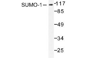 Image no. 1 for anti-Small Ubiquitin Related Modifier Protein 1 (SUMO1) antibody (ABIN271962) (SUMO1 抗体)