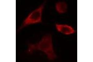 ABIN6275359 staining Hela cells by IF/ICC. (Phospholipase D4 抗体  (C-Term))