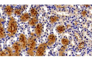 Detection of MEP1a in Mouse Kidney Tissue using Polyclonal Antibody to Meprin A Alpha (MEP1a) (MEP1A 抗体  (AA 219-463))