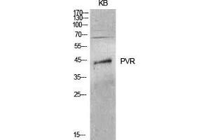 Western Blot (WB) analysis of KB cells using CD155 Polyclonal Antibody. (Poliovirus Receptor 抗体  (Internal Region))
