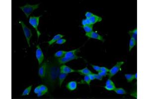 Immunofluorescence staining of undifferentiated SH-SY5Y cells (Human neuroblastoma, ATCC CRL-2266) (left) and differentiated SH-SY5Y cells (right). (GRIP1 抗体  (AA 877-1067))