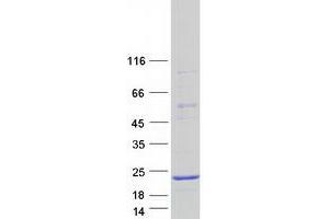 Western Blotting (WB) image for Calmodulin-Like 4 (CALML4) (Transcript Variant 2) protein (Myc-DYKDDDDK Tag) (ABIN2713053)