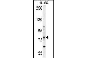 Western blot analysis in HL-60 cell line lysates (35ug/lane). (ABCD1 抗体  (AA 257-285))