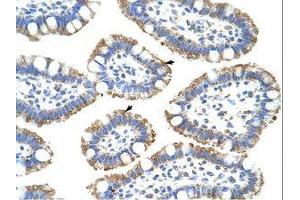 Image no. 1 for anti-Splicing Factor 3b, Subunit 4, 49kDa (SF3B4) (N-Term) antibody (ABIN202492) (SF3B4 抗体  (N-Term))