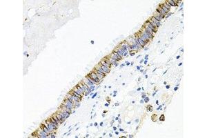 Immunohistochemistry of paraffin-embedded Human lung using ACVR2A Polyclonal Antibody at dilution of 1:100 (40x lens).