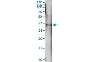 Immunoprecipitation (IP) image for anti-General Transcription Factor IIH, Polypeptide 3, 34kD (GTF2H3) (AA 1-308) antibody (ABIN516271)