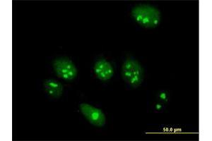 Immunofluorescence of purified MaxPab antibody to ABT1 on HeLa cell. (Activator of Basal Transcription 1 抗体  (AA 1-272))