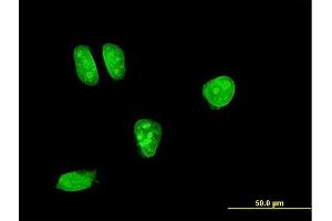 Immunofluorescence of monoclonal antibody to MAP2K7 on HeLa cell. (MAP2K7 抗体  (AA 1-99))