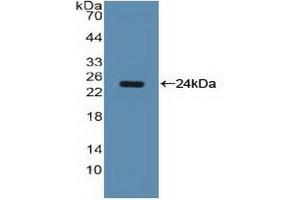 Western blot analysis of recombinant Human NCL. (Nucleolin 抗体  (AA 388-569))