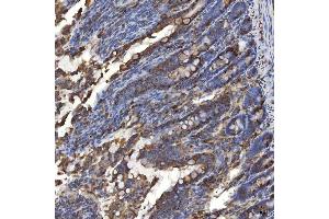 IHC analysis of TXNDC5 using anti-TXNDC5 antibody (ABIN7599699).