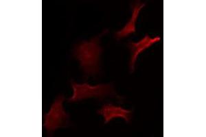 anti-Zinc Finger, DHHC-Type Containing 20 (ZDHHC20) (Internal Region) antibody