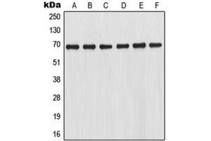 Western blot analysis of NRF2 expression in THP1 (A), HL60 (B), K562 (C), Jurkat (D), mouse kidney (E), rat kidney (F) whole cell lysates. (NRF2 抗体  (C-Term))