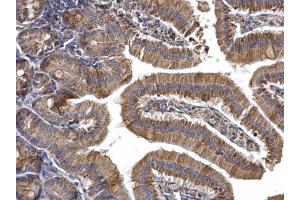 Immunohistochemistry (IHC) image for anti-Protein Kinase, AMP-Activated, alpha 2 Catalytic Subunit (PRKAA2) (Center) antibody (ABIN2855639)