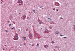 anti-14-3-3 theta (YWHAQ) (AA 1-245) antibody