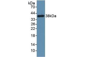Western blot analysis of recombinant Mouse PDGFRb. (PDGFRB 抗体  (AA 337-583))