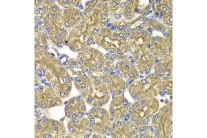 Immunohistochemistry of paraffin-embedded rat kidney using PSMD5 antibody at dilution of 1:100 (x400 lens). (PSMD5 抗体)