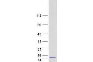 Western Blotting (WB) image for Catenin, beta Interacting Protein 1 (CTNNBIP1) (Transcript Variant 2) protein (Myc-DYKDDDDK Tag) (ABIN2712612)