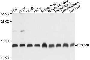 Western blot analysis of extracts of various cells, using UQCRB antibody. (UQCRB 抗体)